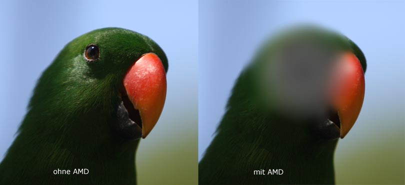 AMD-Vergleich (Altersbedingte Makuladegeneration)